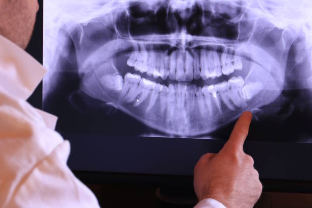 Best Emergency Dental Surgery in Natchitoches, LA