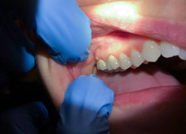 Best Emergency Dental Care for Trauma or Injury in Natchitoches, LA